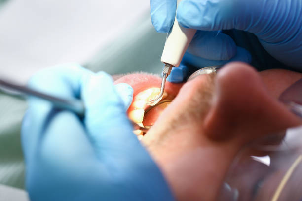 Best Walk-In Emergency Dental Services in Odon, IN