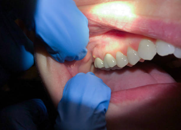 Best Emergency Treatment for Jaw Pain or Injury in Odon, IN