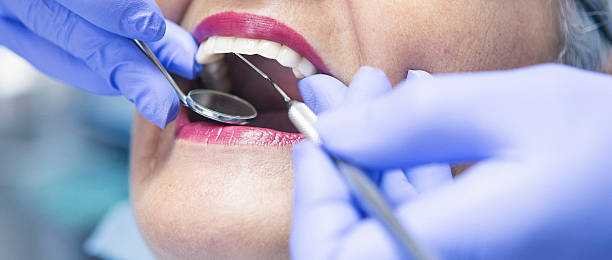 Best Broken or Chipped Tooth Repair in Odon, IN